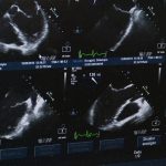 Quand et pourquoi réaliser une échographie abdomino-pelvienne ?